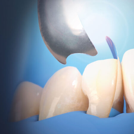 UNICA PROXIMAL MATRICI ANTERIORI